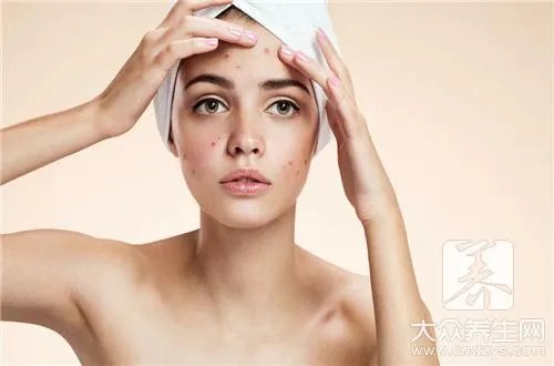 去豆印的有效方法小妙法