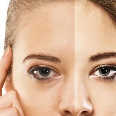 更好的祛斑方法是什么