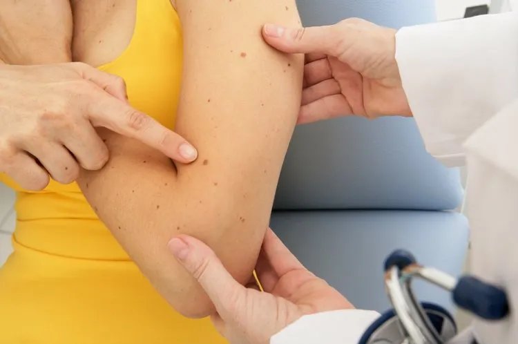 癌症来临前,身体会发出“求救信号”,越早发现越好,别不重视