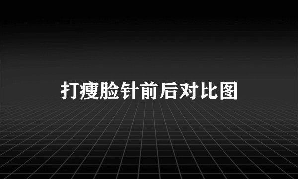 打瘦脸针前后对比图