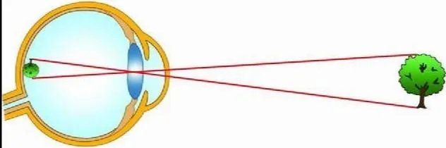 一加8pro镜头透视是炒作还是事实,你怎么看?