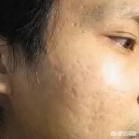 纯天然的护肤品牌都有哪些?