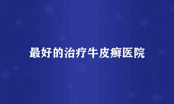 最好的治疗牛皮癣医院