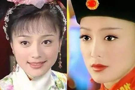 秦岚出入美容诊所 疑似整容实为皮肤过敏