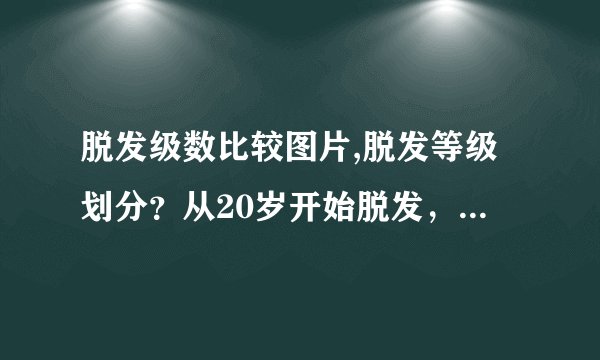 脱发级数比较图片,脱发等级划分？从20岁开始脱发，现在...